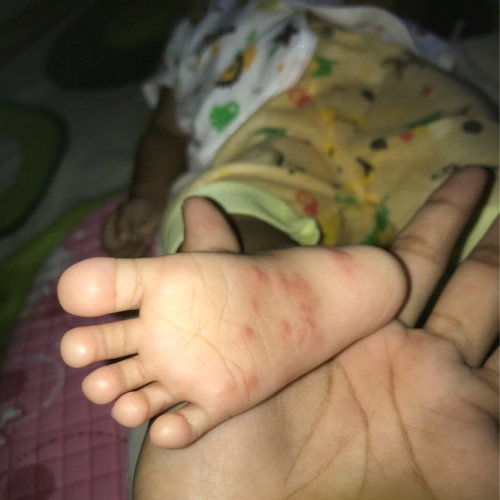 Seperti gatal yang menyebar