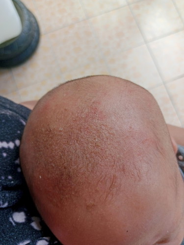 หัวลูกแห้งเป็นรอยแตก