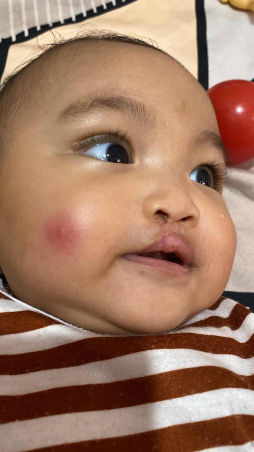 Pipi merah