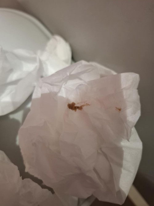 ตรวจครรภ์เเล้วพบว่าท้องผ่านมาประมาน2สัปดาว์เเล้วมีอะไรเเบบนี้ออกมา