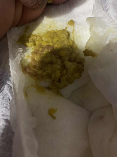 Mga mami normal lang poba ito sa 3weeks old?🥹