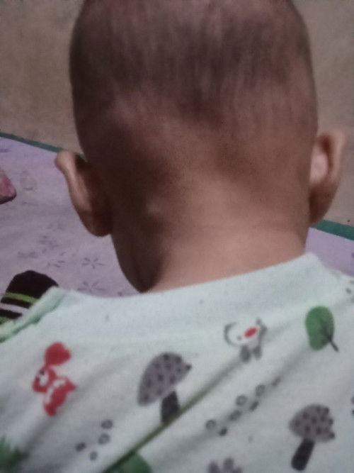 Benjolan atau apa ??