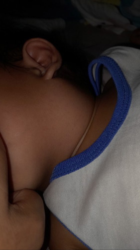 My tumubong bukol sa my leeg ni baby sinu po my ganitong case?