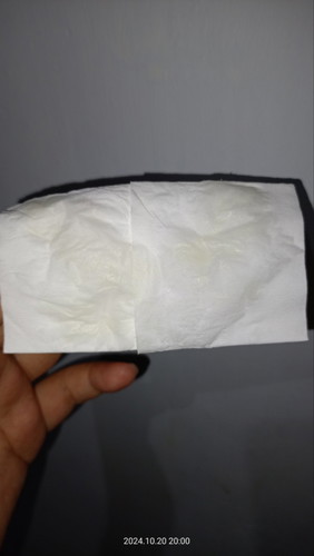 Ketuban rembes atau keputihan???