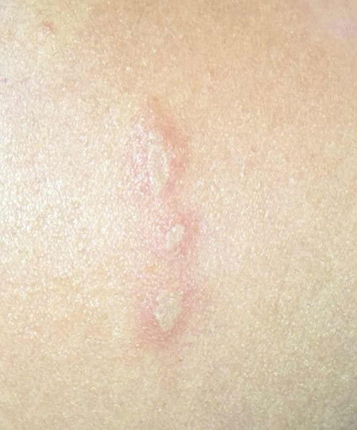 รบกวนช่วยดูให้หน่อยค่ะว่าเป็นอะไร