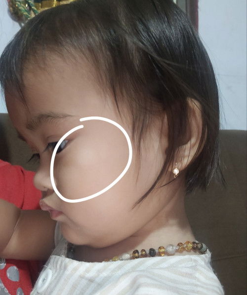 Putih-putih di wajah