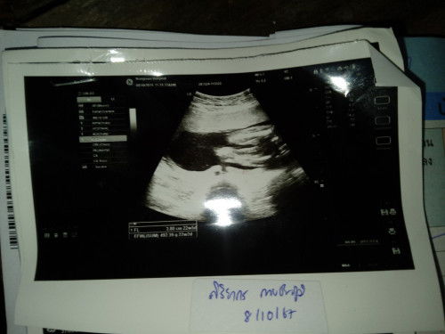 แม่ๆช่วยดูหน่อยคะว่าผู้หญิงหรือผู้ชาย