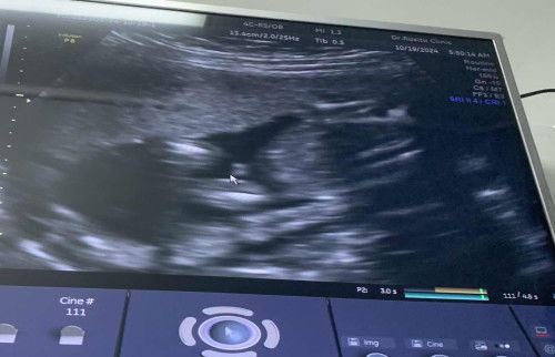 สอบถามหน่อยค่ะ