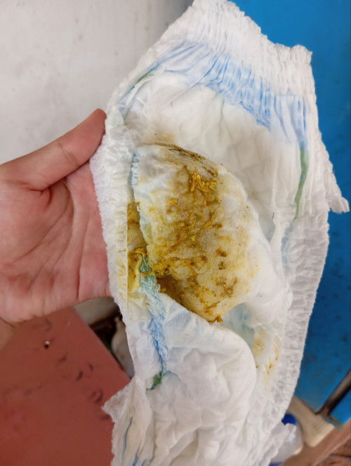 อุจจาระแบบนี้ปกติมั้ยคะ