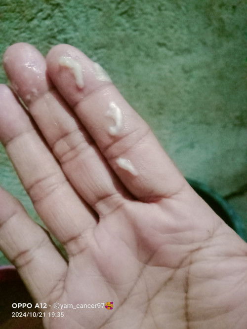 Ano po ibig sabihin po nto 38 weeks po akong buntis tapus my lumabas sa akin na gnto