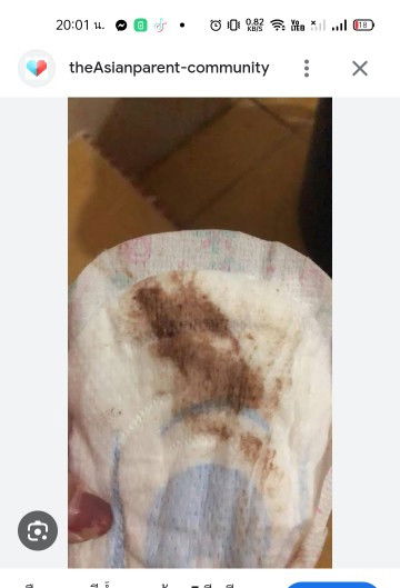 น้ำคาวปลา หลังคลอด