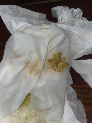 ถ่ายลักษณะแบบนี้