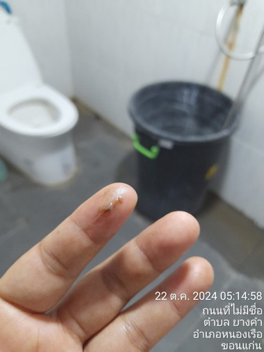 สอบถามค่ะท้องใกล้คลอดแล้วมีมูกแบบนี้อันตายไหมควรไปหาหมอไหมค่ะ