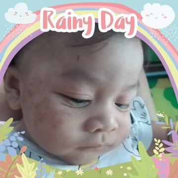 ผื่นแบบนี้เเพ้นมวัวไหม