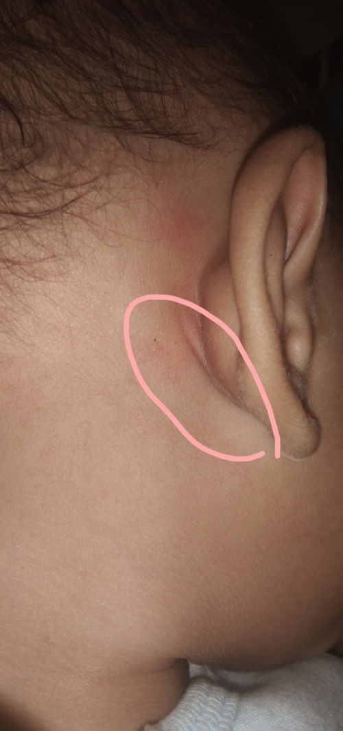 แบบนี้คือก้อนอะไรคะแม่