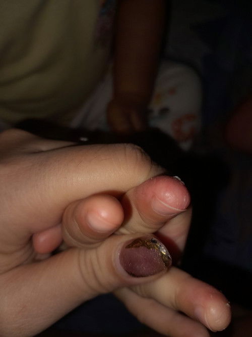 Mom tanya anak tangan saya seperti ini