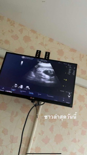 แม่ๆช่วยดูเพศน้องให้หน่อยค่ะ