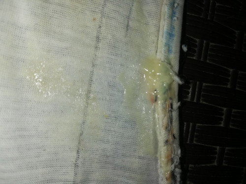 Normal Po ba to? Gumagamit na din ng EVENING PRIMEROSE OIL si misis..