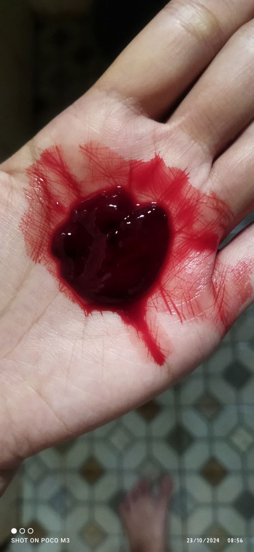 Darah haid atau bukan yaaa