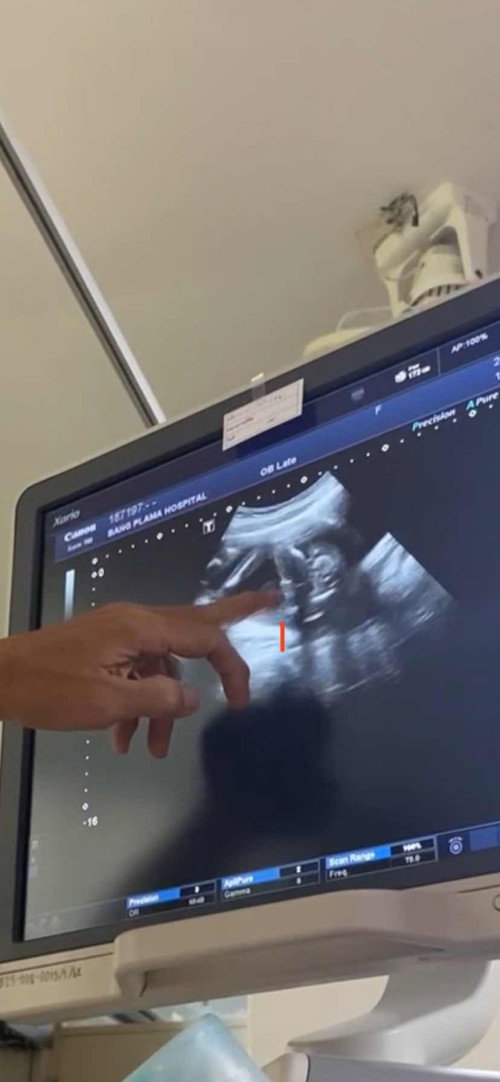 แม่ๆช่วยดูให้หน่อยค่ะว่าน้องเป็นผชจริงๆมั้ยคุณหมอบอกน้องมีจู๋ค่ะไม่แน่ใจเลย