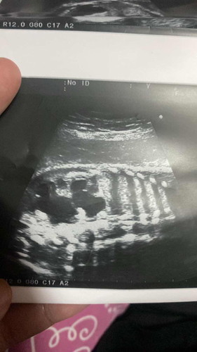 กังวลมากค่ะแม่ๆ