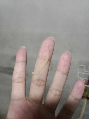 36w มีมูกออกสีน้ำตาลแบบนี้ แม่คนไหนเคยเป็นบ้างคะ