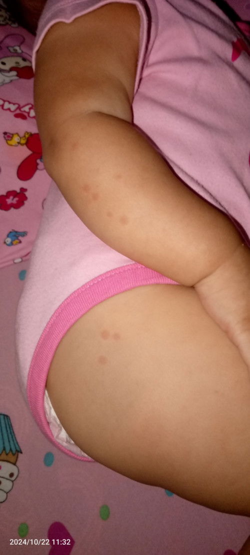 Co-Amoxiclav Natravox