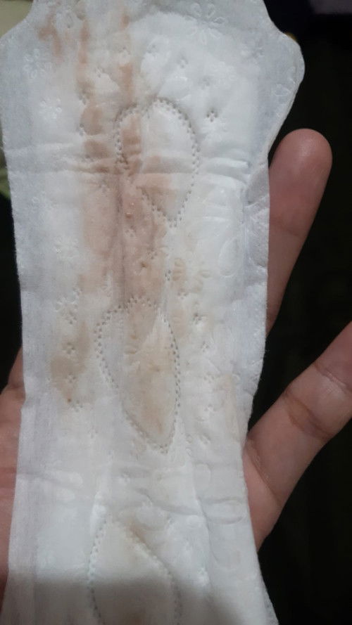 Flek setelah hb usia 18 week