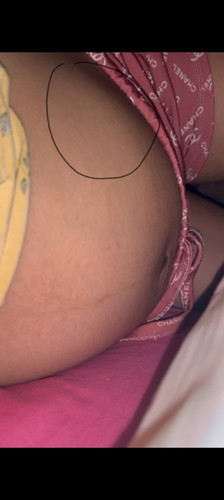 Breech position 29 weeks