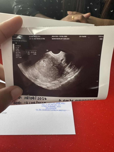 7w scan tapi nampak kantung je