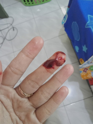MAAF BUN jorok Yahh, saya 4 minggu 2 hari, tiba2 keluar begini..ini knp yah bun..qpakah keguguran