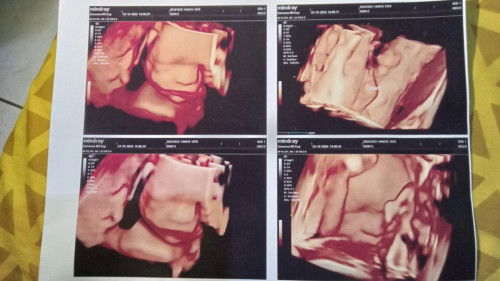 Sharing dapet baby apa bun ?