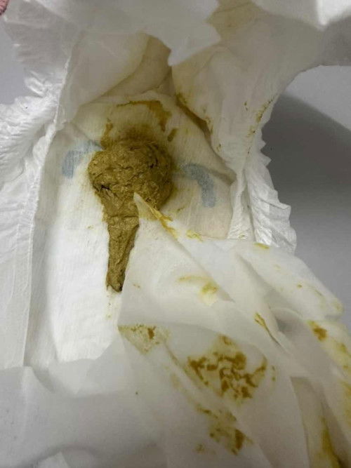 Najis baby sembelit atau tak