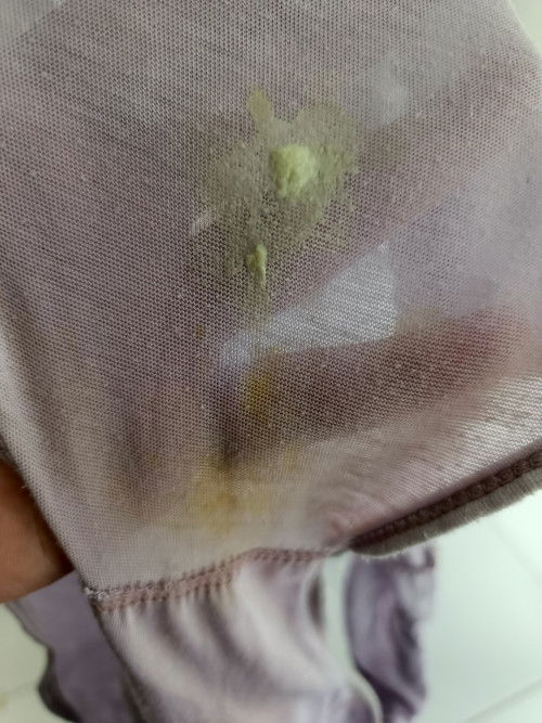 Keputihan Berwarna dan agak bau amis