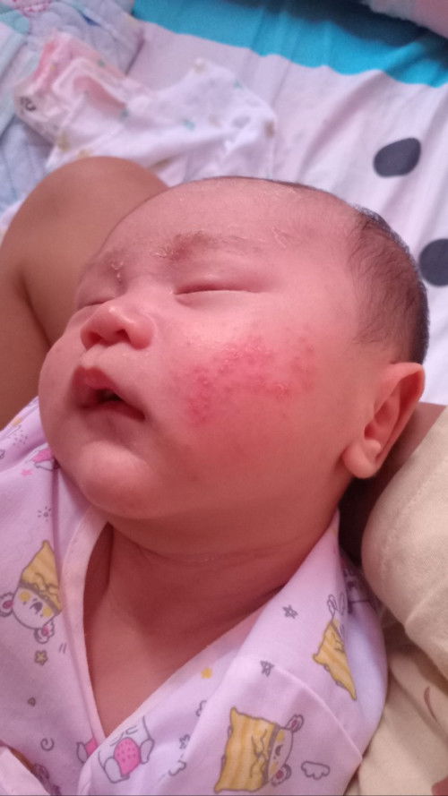 แรกเกิด 1 เดือน