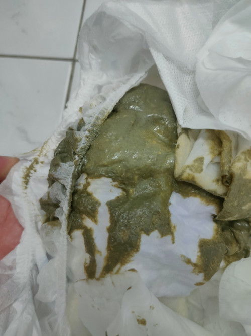Greenish poop With HA milk