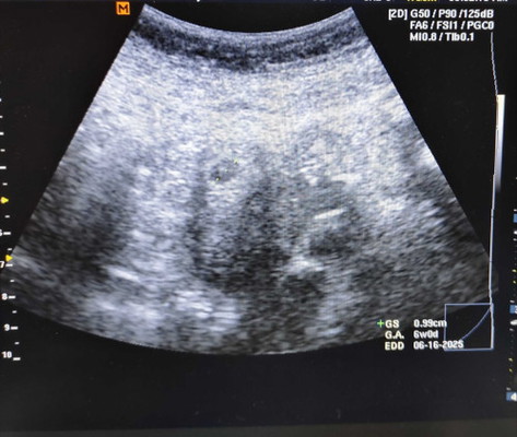 .99cm 6weeks na 😥😥