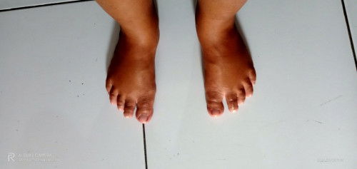 Hamil 34w kaki bengkak kenapa ya...? Apa karna kalau duduk suka di gantung ...?