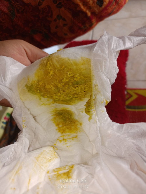 Pup wrna kuning ada hijaunya