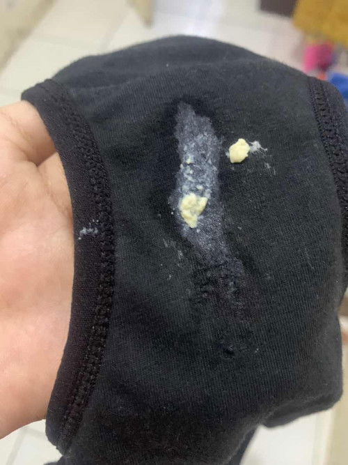 keputihan hamil 29 wek