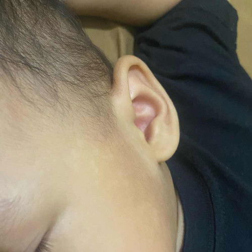 Muka Anak totol totol Putih