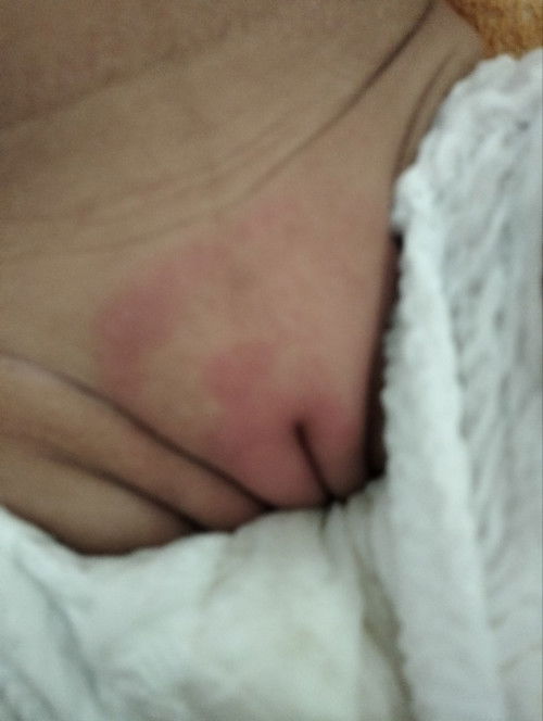 รักษายังไงคะถ้า เป็นแบบนี้