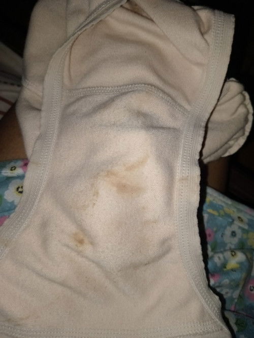 Mau nanya ini tanda lahiran apa bukan