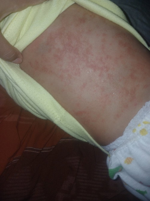 Biyang keringat bayi 8 bulan
