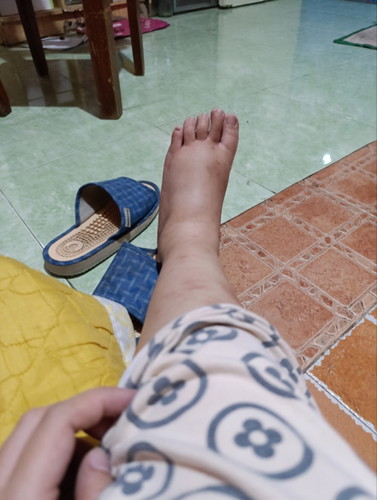 Pamamanas at 32 weeks