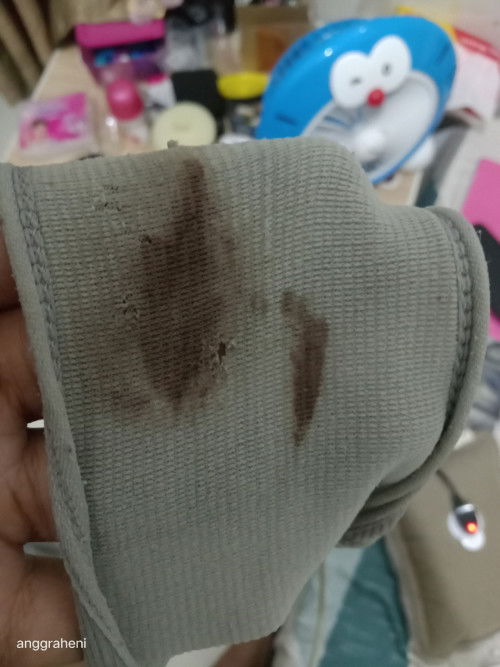 Hamil 10 Minggu Flek kecokltaan