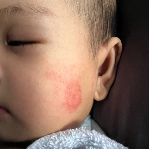 SHARE PUNCA DAN SOLUSI