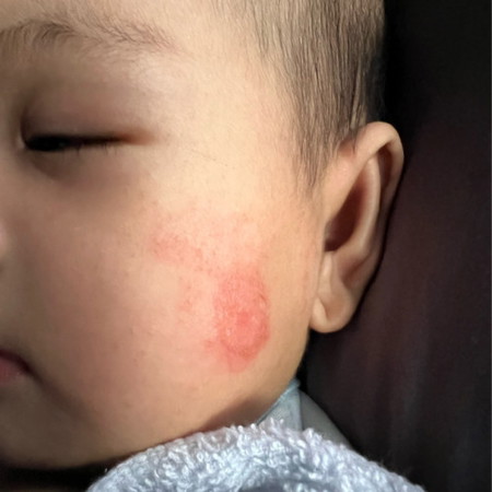 SHARE PUNCA DAN SOLUSI