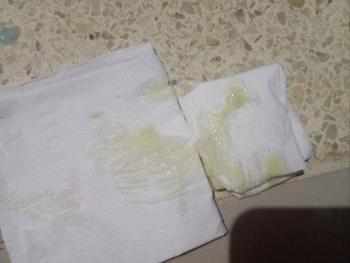 Keputihan berwarna kuning di 37 weeks