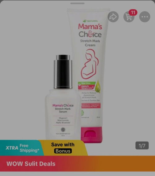 How to avoid stretchmarks